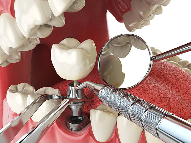 Best Broken Tooth Emergency  in Reidland, KY